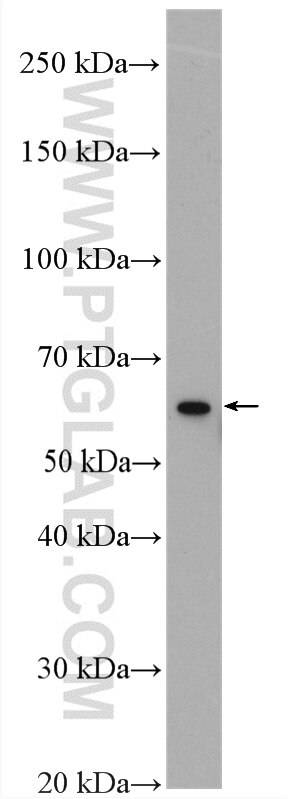 Western Blot (WB) analysis of mouse spleen tissue using PADI4 Polyclonal antibody (17373-1-AP)