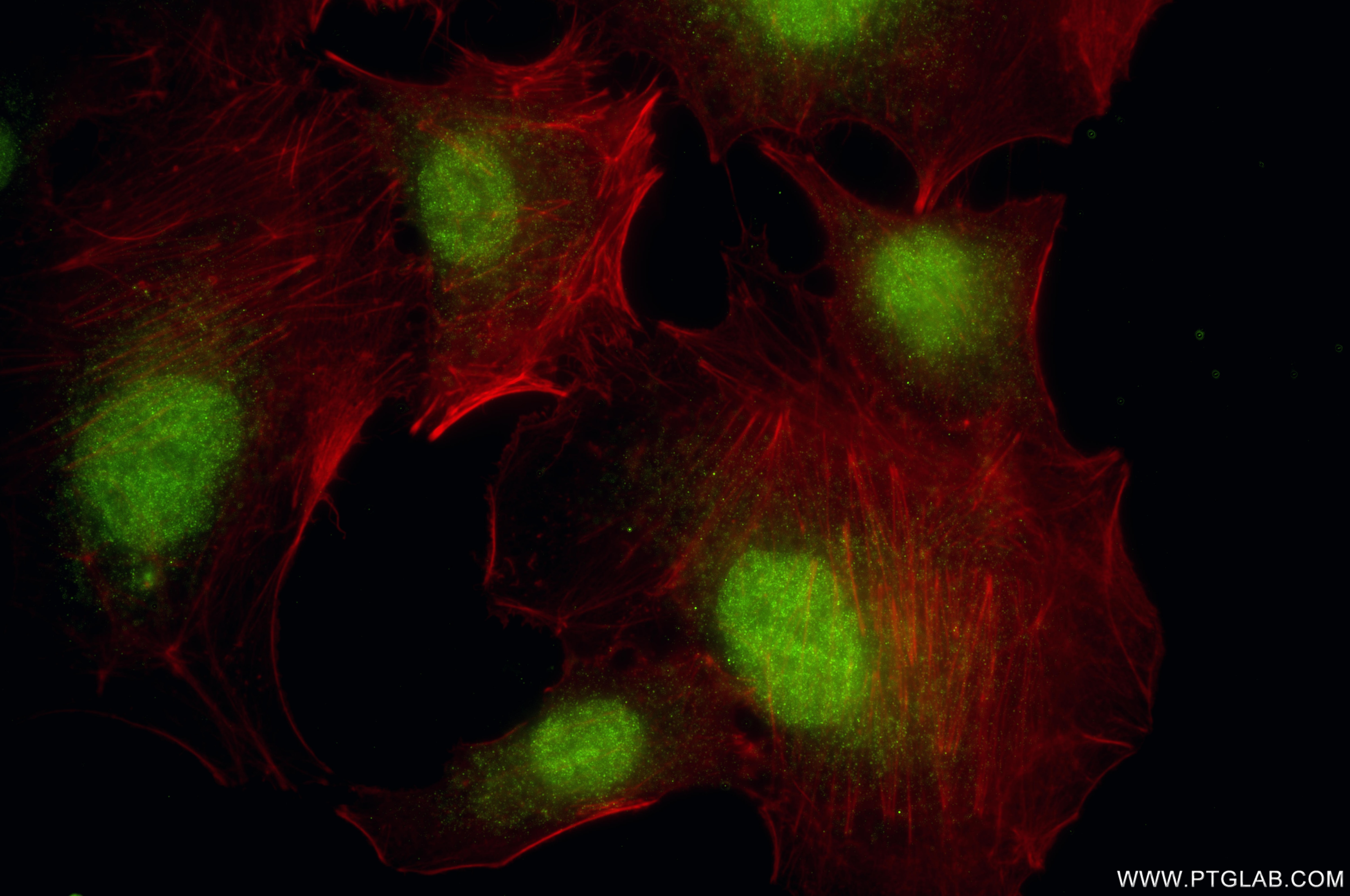 IF Staining of A549 using 86419-1-RR Immunofluorescence (IF) / fluorescent staining of A549 cells using PADI4 Recombinant monoclonal antibody (86419-1-RR)