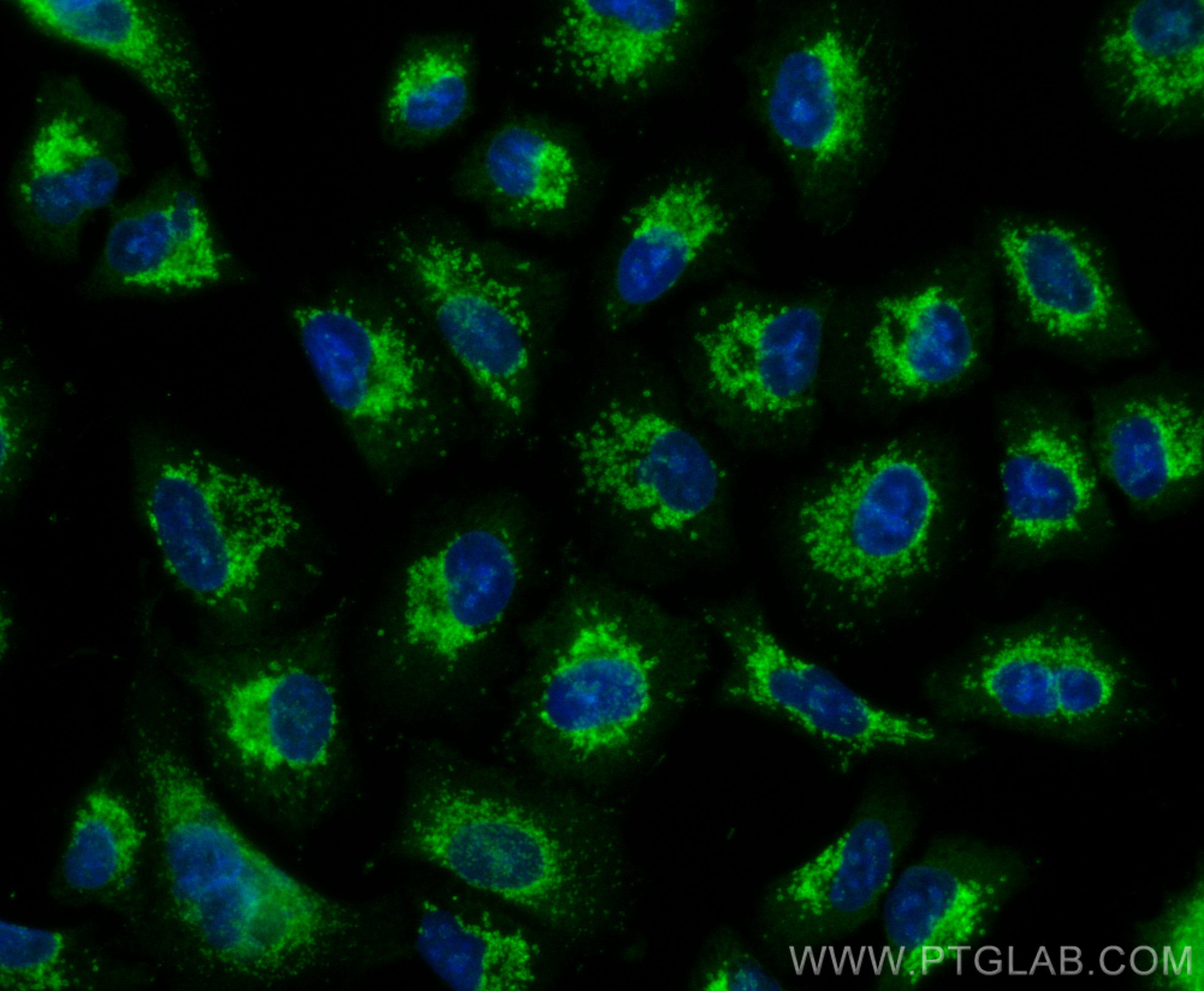 Immunofluorescence (IF) / fluorescent staining of A549 cells using CoraLite® Plus 488-conjugated PADI4 Polyclonal ant (CL488-17373)
