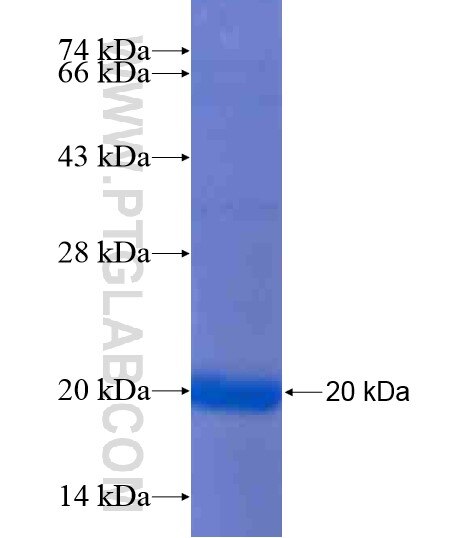 PADI6 fusion protein Ag20386 SDS-PAGE