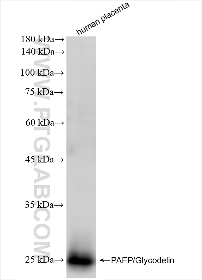 Western Blot (WB) analysis of human placenta tissue using PAEP/Glycodelin Recombinant antibody (85856-2-RR)