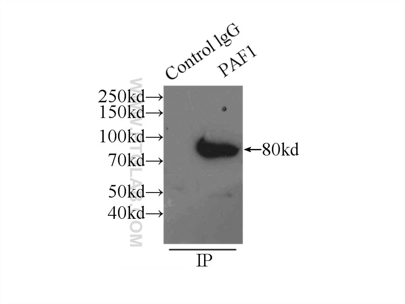 Immunoprecipitation (IP) experiment of HeLa cells using PAF1 Polyclonal antibody (15441-1-AP)