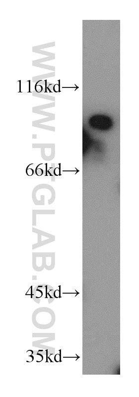 Western Blot (WB) analysis of HepG2 cells using PAF1 Polyclonal antibody (15441-1-AP)