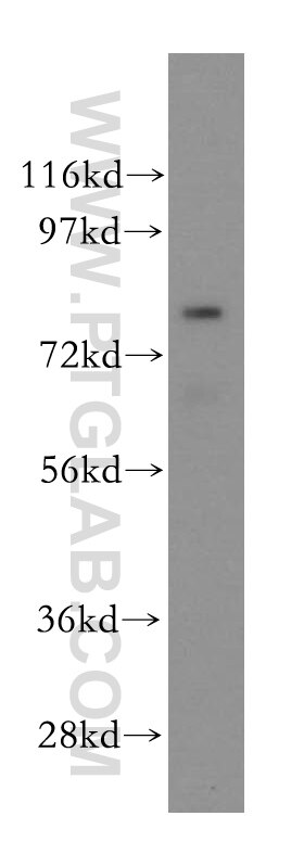 Western Blot (WB) analysis of HeLa cells using PAF1 Polyclonal antibody (15441-1-AP)