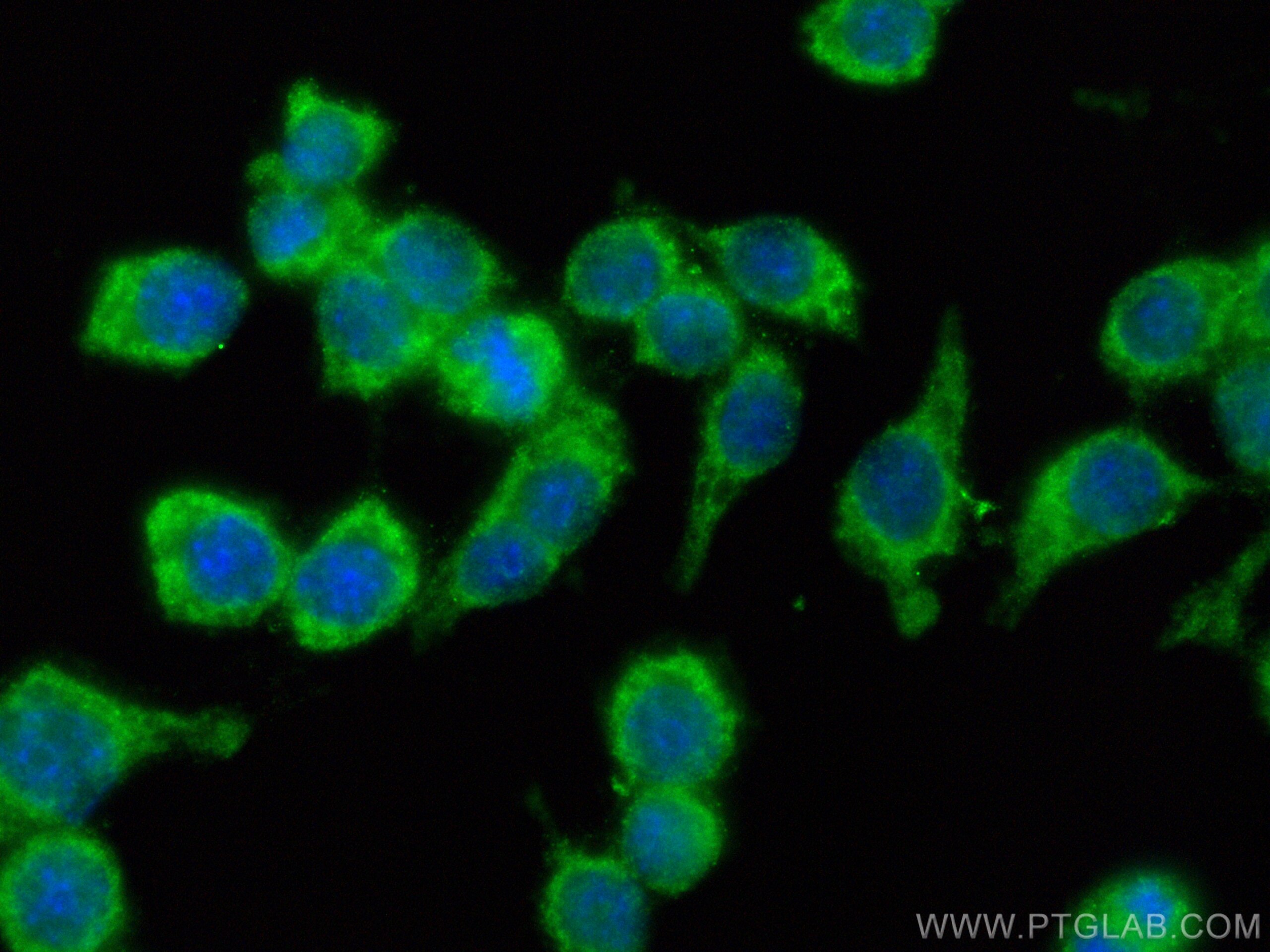 IF Staining of RAW 264.7 using CL488-15526