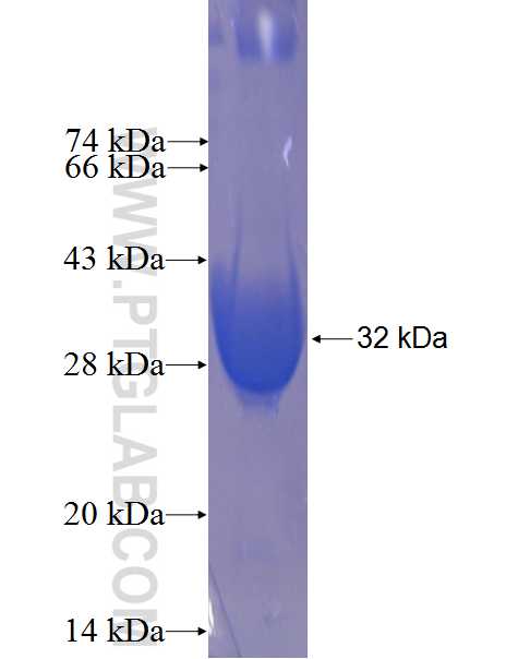 PAFAH1B2 fusion protein Ag6576 SDS-PAGE