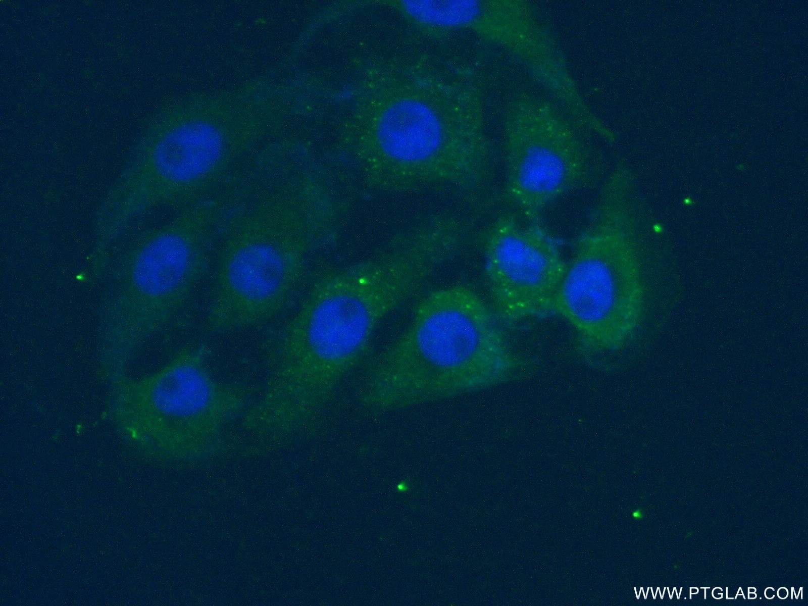 Immunofluorescence (IF) / fluorescent staining of SH-SY5Y cells using PAFAH1B3 Polyclonal antibody (20564-1-AP)