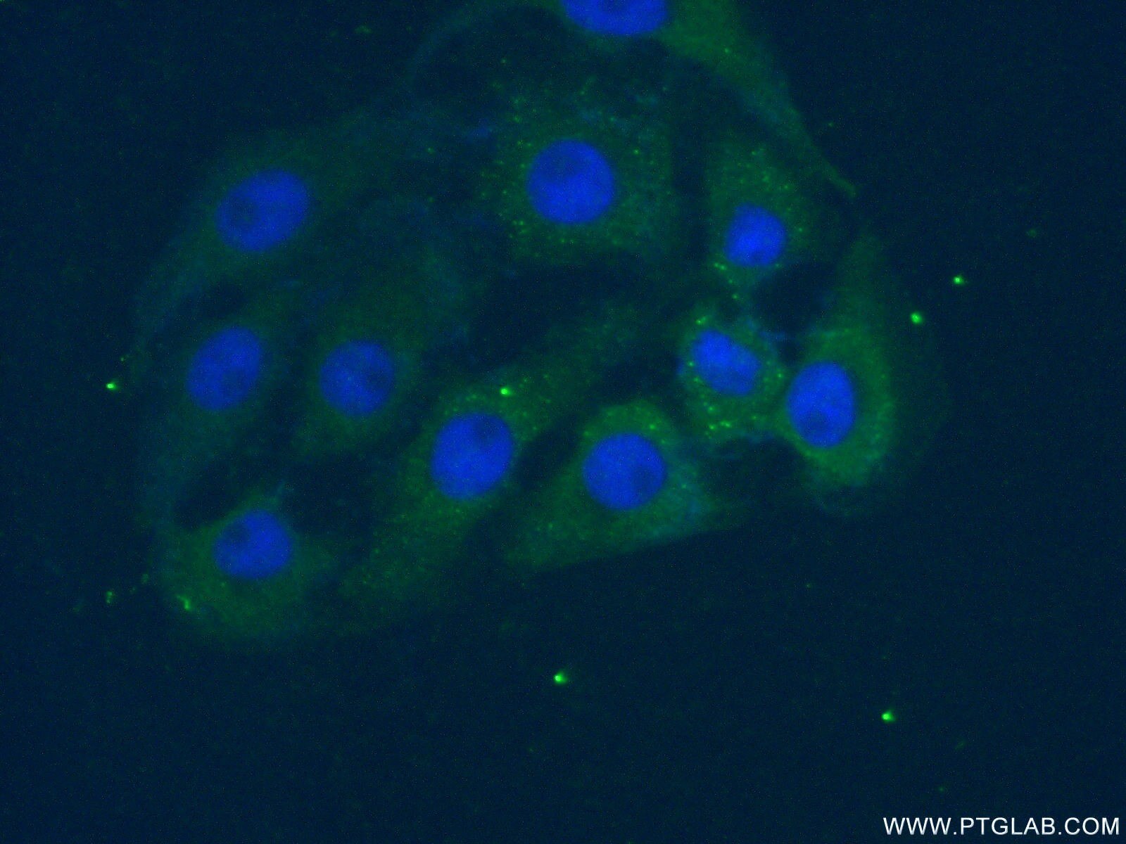 Immunofluorescence (IF) / fluorescent staining of SH-SY5Y cells using PAFAH1B3 Polyclonal antibody (20564-1-AP)