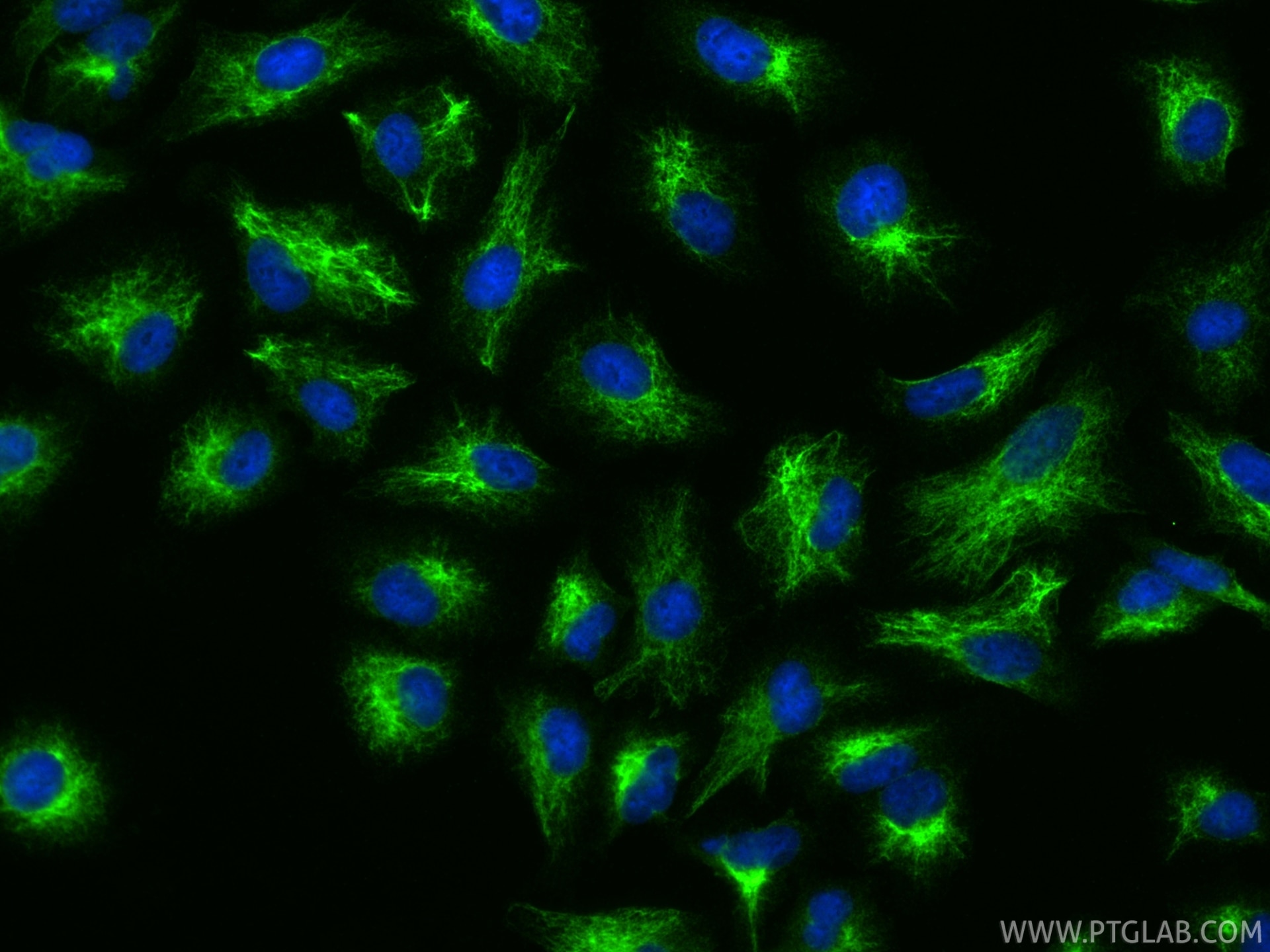 Immunofluorescence (IF) / fluorescent staining of A549 cells using PAFAH1B3 Polyclonal antibody (20564-1-AP)