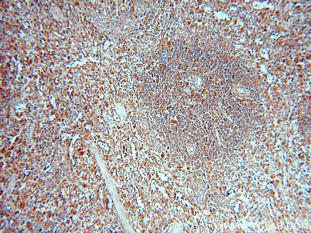 Immunohistochemistry (IHC) staining of human spleen tissue using PAFAH1B3 Polyclonal antibody (20564-1-AP)