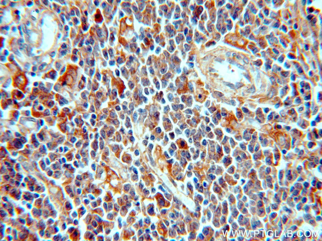Immunohistochemistry (IHC) staining of human spleen tissue using PAFAH1B3 Polyclonal antibody (20564-1-AP)