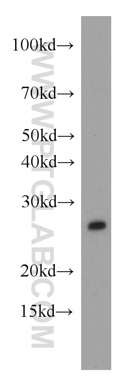 Western Blot (WB) analysis of human brain tissue using PAFAH1B3 Polyclonal antibody (20564-1-AP)