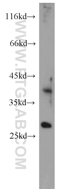 Western Blot (WB) analysis of human brain tissue using PAFAH1B3 Polyclonal antibody (20564-1-AP)