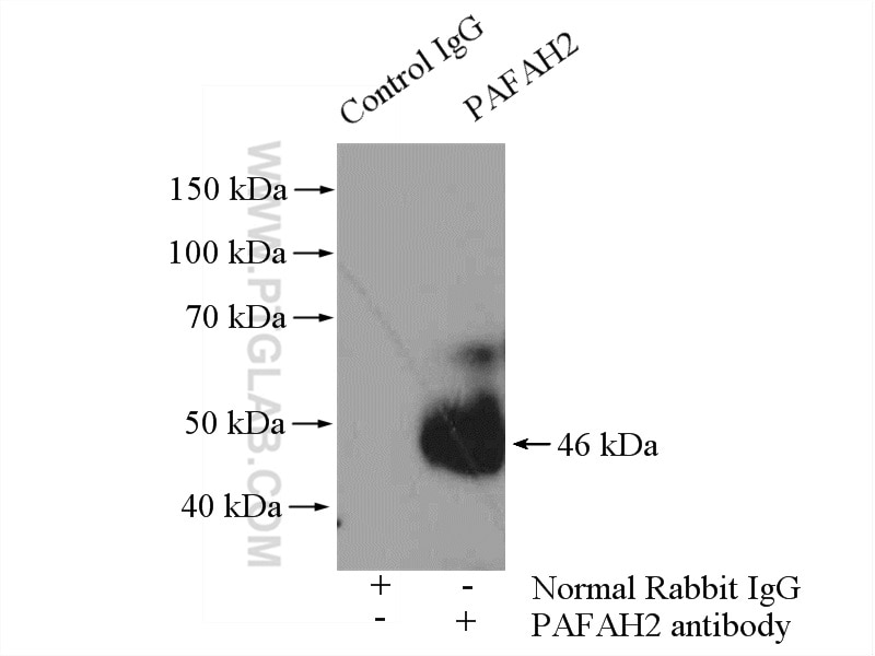 Immunoprecipitation (IP) experiment of mouse liver tissue using PAFAH2 Polyclonal antibody (10085-1-AP)