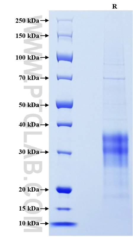 Purity of Recombinant Human IFN-gamma was determined by SDS-PAGE. The protein was resolved in an SDS-PAGE in reducing (R) conditions and stained using Coomassie blue.