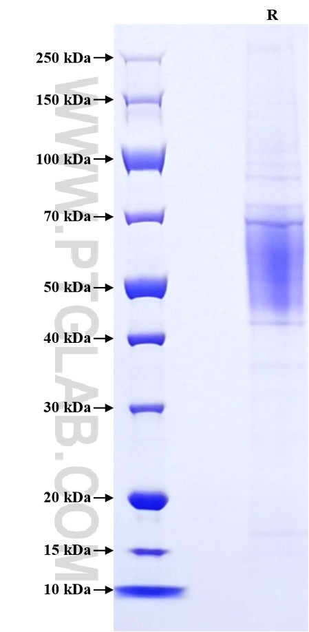 Purity of Recombinant Human CD200R1 was determined by SDS-PAGE. The protein was resolved in an SDS-PAGE in reducing (R) conditions and stained using Coomassie blue.