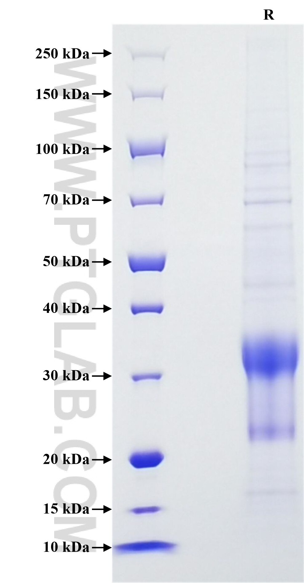 Purity of Recombinant Human CTLA-4 was determined by SDS-PAGE. The protein was resolved in an SDS-PAGE in reducing (R) conditions and stained using Coomassie blue.