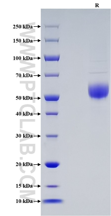 Purity of Recombinant Human ICOS was determined by SDS-PAGE. The protein was resolved in an SDS-PAGE in reducing (R) conditions and stained using Coomassie blue. Purity of Recombinant Human ICOS was determined by SDS-PAGE. The protein was resolved in an SDS-PAGE in reducing (R) conditions and stained using Coomassie blue.