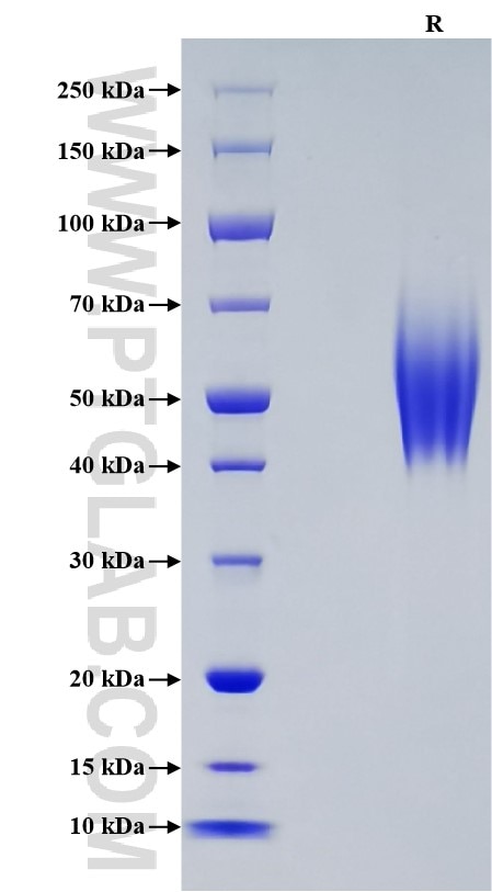 Purity of Recombinant Human CEACAM-6 was determined by SDS-PAGE. The protein was resolved in an SDS-PAGE in reducing (R) conditions and stained using Coomassie blue.
