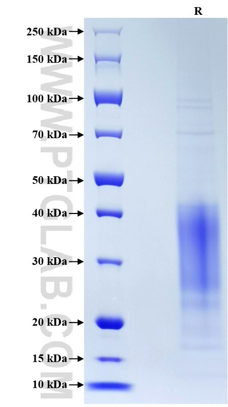 Purity of Recombinant Human IL-13 was determined by SDS-PAGE. The protein was resolved in an SDS-PAGE in reducing (R) conditions and stained using Coomassie blue. Purity of Recombinant Human IL-13 was determined by SDS-PAGE. The protein was resolved in an SDS-PAGE in reducing (R) conditions and stained using Coomassie blue.