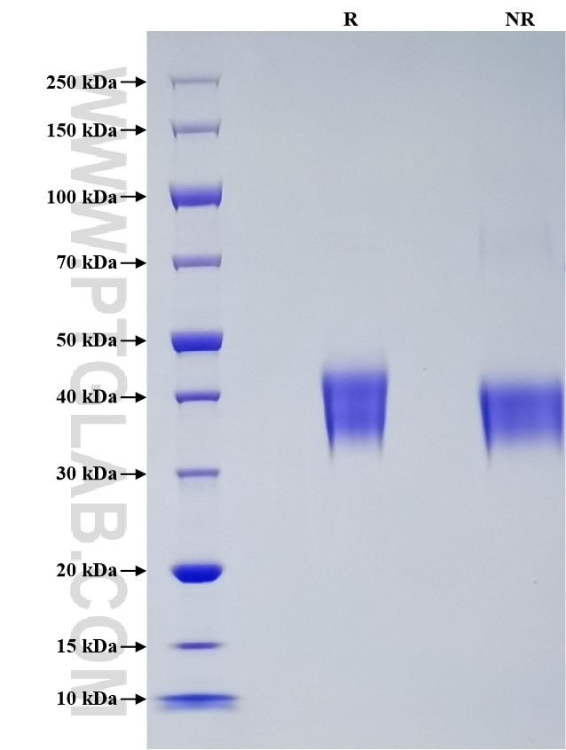 Purity of Recombinant SARS-CoV-2 Spike RBD was determined by SDS-PAGE. The protein was resolved in an SDS-PAGE in reducing (R) and non-reducing (NR) conditions and stained using Coomassie blue. Purity of Recombinant SARS-CoV-2 Spike RBD was determined by SDS-PAGE. The protein was resolved in an SDS-PAGE in reducing (R) and non-reducing (NR) conditions and stained using Coomassie blue.