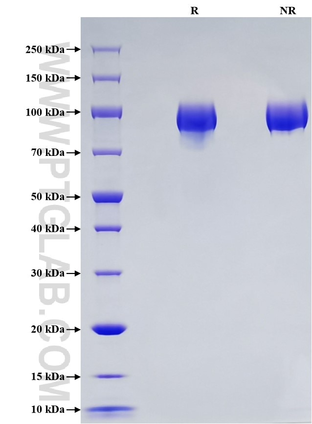 Purity of Recombinant Human ACE2 was determined by SDS-PAGE. The protein was resolved in an SDS-PAGE in reducing (R) and non-reducing (NR) conditions and stained using Coomassie blue.