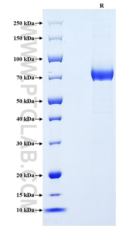 Purity of Recombinant Human Galectin-9 was determined by SDS-PAGE. The protein was resolved in an SDS-PAGE in reducing (R) conditions and stained using Coomassie blue.
