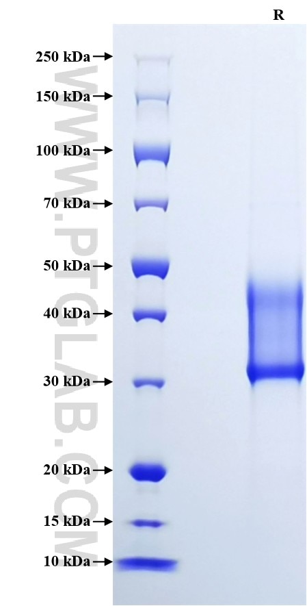 Purity of Recombinant Human IGFBP6 was determined by SDS-PAGE. The protein was resolved in an SDS-PAGE in reducing (R) conditions and stained using Coomassie blue.