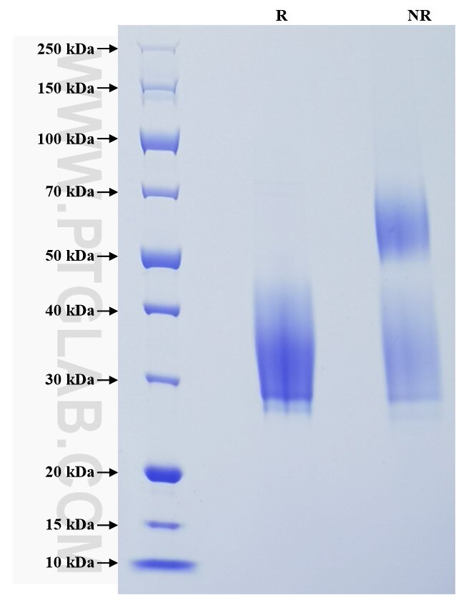 Purity of Recombinant Human SCF was determined by SDS-PAGE. The protein was resolved in an SDS-PAGE in reducing (R) and non-reducing (NR) conditions and stained using Coomassie blue. Purity of Recombinant Human SCF was determined by SDS-PAGE. The protein was resolved in an SDS-PAGE in reducing (R) and non-reducing (NR) conditions and stained using Coomassie blue.