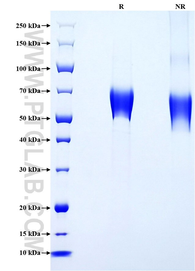 Purity of Recombinant Human IL-1R2 was determined by SDS-PAGE. The protein was resolved in an SDS-PAGE in reducing (R) and non-reducing (NR) conditions and stained using Coomassie blue.
