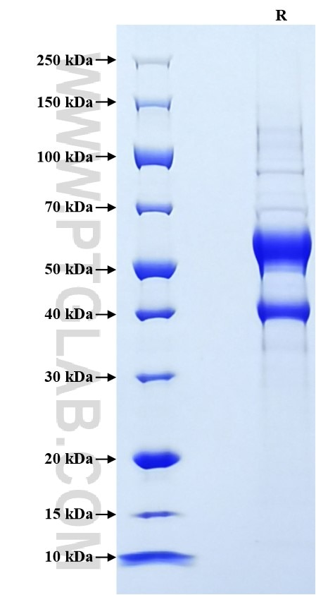 Purity of Recombinant Human VEGF-B was determined by SDS-PAGE. The protein was resolved in an SDS-PAGE in reducing (R) conditions and stained using Coomassie blue. Purity of Recombinant Human VEGF-B was determined by SDS-PAGE. The protein was resolved in an SDS-PAGE in reducing (R) conditions and stained using Coomassie blue.