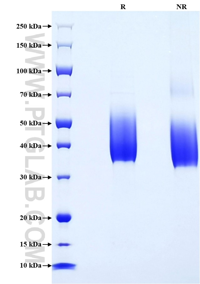 Purity of Recombinant Human SLAMF7 was determined by SDS-PAGE. The protein was resolved in an SDS-PAGE in reducing (R) and non-reducing (NR) conditions and stained using Coomassie blue. Purity of Recombinant Human SLAMF7 was determined by SDS-PAGE. The protein was resolved in an SDS-PAGE in reducing (R) and non-reducing (NR) conditions and stained using Coomassie blue.