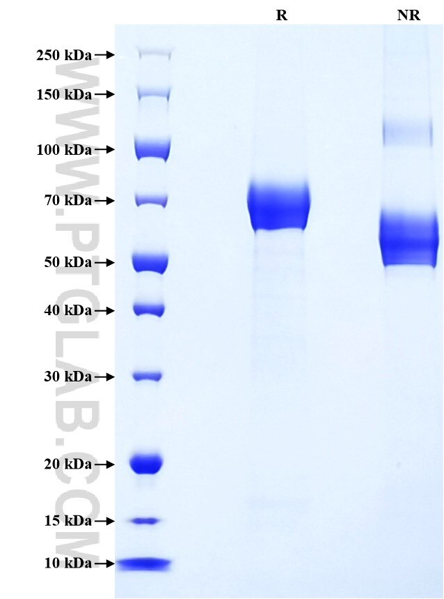 Purity of Recombinant Human EPHA2 was determined by SDS-PAGE. The protein was resolved in an SDS-PAGE in reducing (R) and non-reducing (NR) conditions and stained using Coomassie blue.