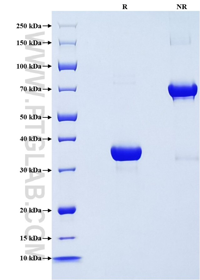 Purity of Recombinant Mouse CXCL1 was determined by SDS-PAGE. The protein was resolved in an SDS-PAGE in reducing (R) and non-reducing (NR) conditions and stained using Coomassie blue.