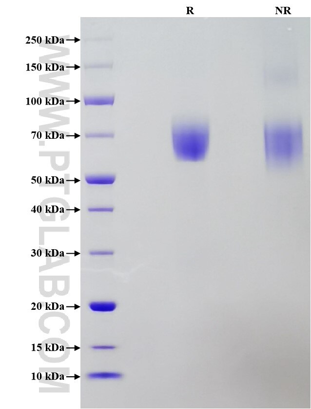 Purity of Recombinant Human IL-6R alpha was determined by SDS-PAGE. The protein was resolved in an SDS-PAGE in reducing (R) and non-reducing (NR) conditions and stained using Coomassie blue.