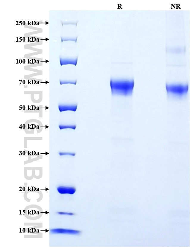 Purity of Recombinant Human FGFRL1 was determined by SDS-PAGE. The protein was resolved in an SDS-PAGE in reducing (R) and non-reducing (NR) conditions and stained using Coomassie blue. Purity of Recombinant Human FGFRL1 was determined by SDS-PAGE. The protein was resolved in an SDS-PAGE in reducing (R) and non-reducing (NR) conditions and stained using Coomassie blue.