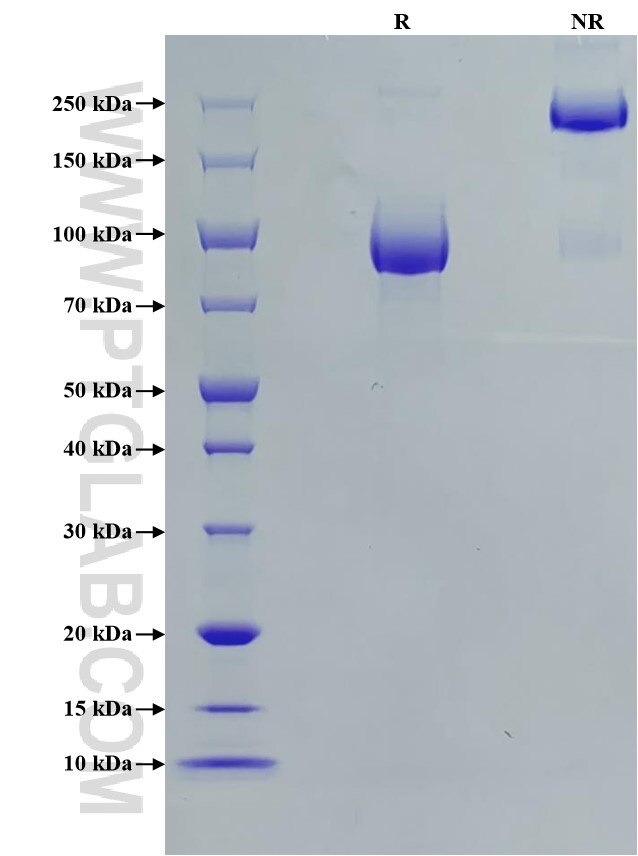 Purity of Recombinant Human FGFR2 (IIIc) was determined by SDS-PAGE. The protein was resolved in an SDS-PAGE in reducing (R) and non-reducing (NR) conditions and stained using Coomassie blue. Purity of Recombinant Human FGFR2 (IIIc) was determined by SDS-PAGE. The protein was resolved in an SDS-PAGE in reducing (R) and non-reducing (NR) conditions and stained using Coomassie blue.