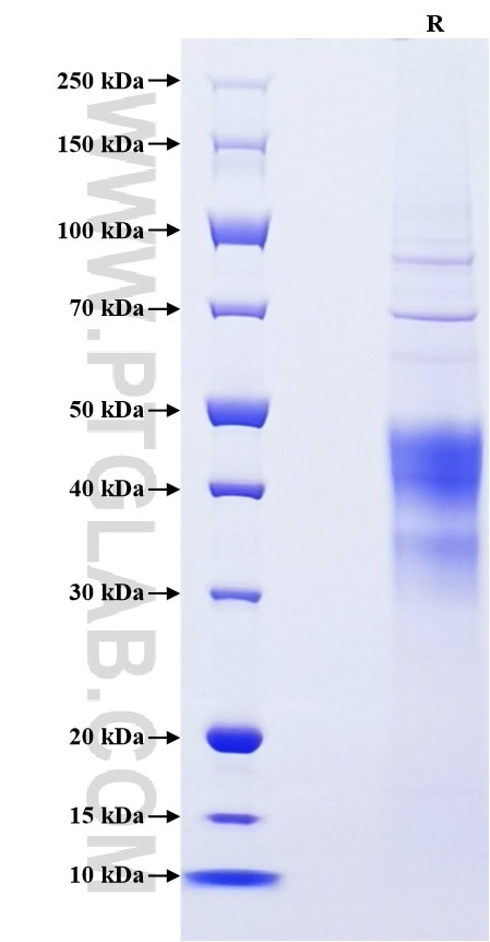Purity of Recombinant Human EPO was determined by SDS-PAGE. The protein was resolved in an SDS-PAGE in reducing (R) conditions and stained using Coomassie blue.