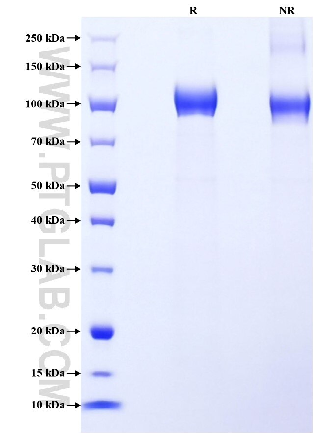 Purity of Recombinant Human CD22 was determined by SDS-PAGE. The protein was resolved in an SDS-PAGE in reducing (R) and non-reducing (NR) conditions and stained using Coomassie blue.