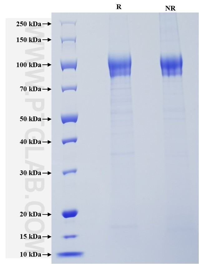Purity of Recombinant Human EGFR was determined by SDS-PAGE. The protein was resolved in an SDS-PAGE in reducing (R) and non-reducing (NR) conditions and stained using Coomassie blue.