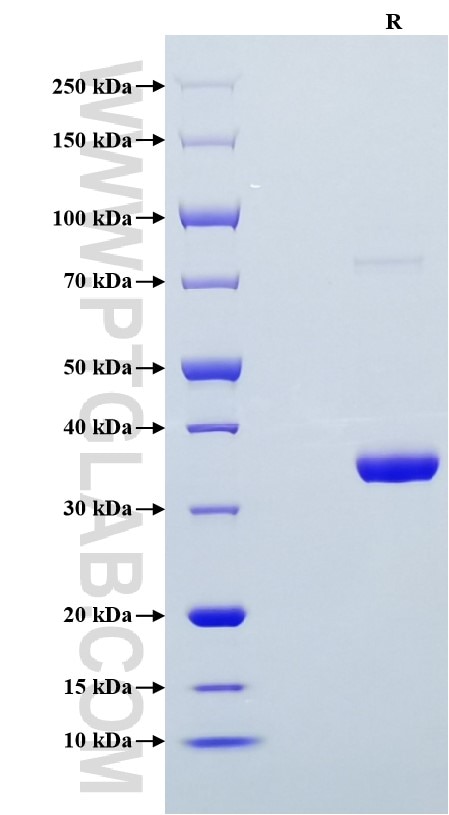 Purity of Recombinant Human IGF1 was determined by SDS-PAGE. The protein was resolved in an SDS-PAGE in reducing (R) conditions and stained using Coomassie blue. Purity of Recombinant Human IGF1 was determined by SDS-PAGE. The protein was resolved in an SDS-PAGE in reducing (R) conditions and stained using Coomassie blue.