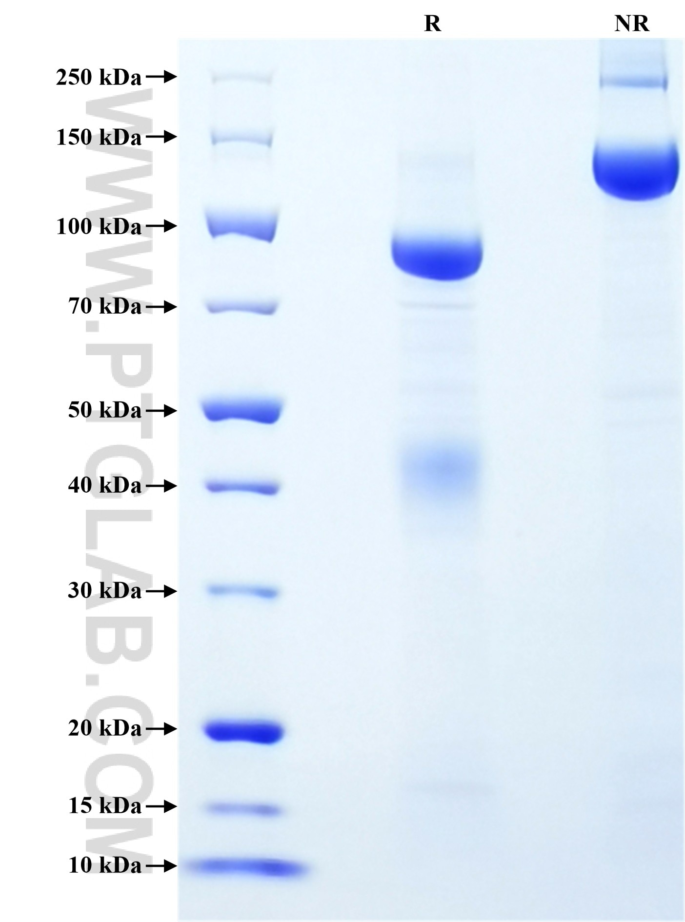 Purity of Recombinant Human MET was determined by SDS-PAGE. The protein was resolved in an SDS-PAGE in reducing (R) and non-reducing (NR) conditions and stained using Coomassie blue. Purity of Recombinant Human MET was determined by SDS-PAGE. The protein was resolved in an SDS-PAGE in reducing (R) and non-reducing (NR) conditions and stained using Coomassie blue.