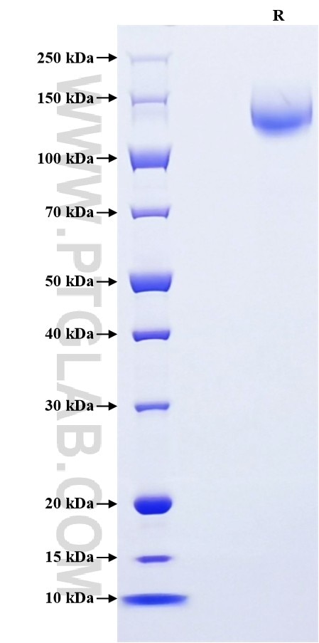Purity of Recombinant Human CEACAM5 was determined by SDS-PAGE. The protein was resolved in an SDS-PAGE in reducing (R) conditions and stained using Coomassie blue.