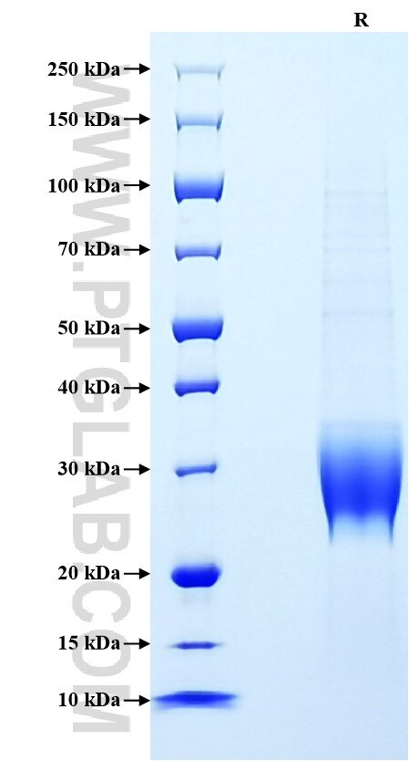 Purity of Recombinant Mouse G-CSF was determined by SDS-PAGE. The protein was resolved in an SDS-PAGE in reducing (R) conditions and stained using Coomassie blue.