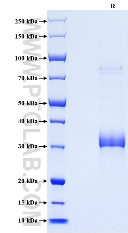 Purity of Recombinant Mouse Adiponectin was determined by SDS-PAGE. The protein was resolved in an SDS-PAGE in reducing (R) conditions and stained using Coomassie blue.