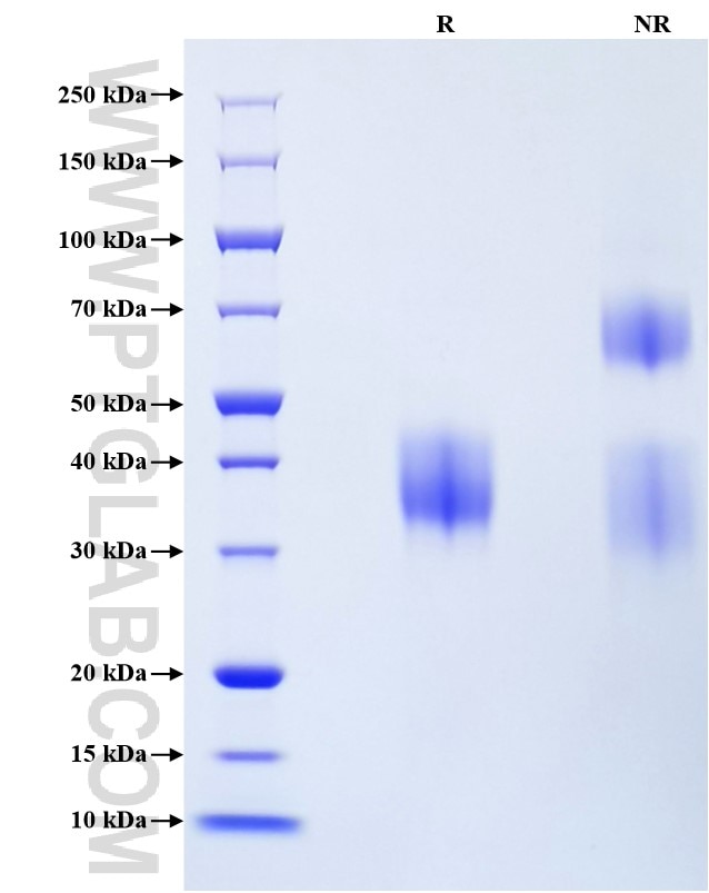 Purity of Recombinant Mouse Erythropoietin was determined by SDS-PAGE. The protein was resolved in an SDS-PAGE in reducing (R) and non-reducing (NR) conditions and stained using Coomassie blue.