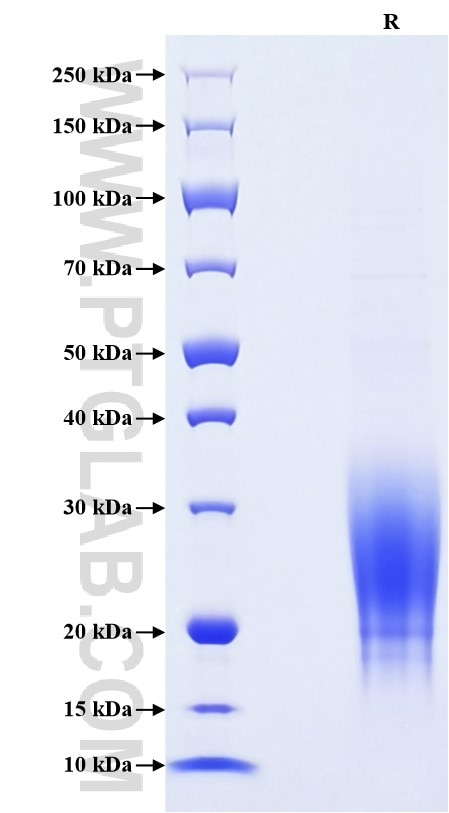 Purity of Recombinant Mouse IL-13 was determined by SDS-PAGE. The protein was resolved in an SDS-PAGE in reducing (R) conditions and stained using Coomassie blue. Purity of Recombinant Mouse IL-13 was determined by SDS-PAGE. The protein was resolved in an SDS-PAGE in reducing (R) conditions and stained using Coomassie blue.