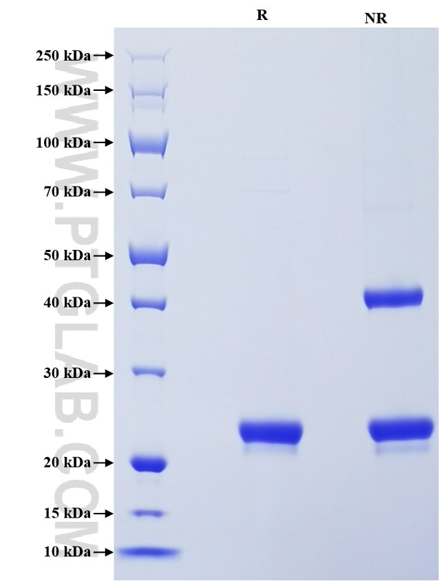 Purity of Recombinant Human NGAL was determined by SDS-PAGE. The protein was resolved in an SDS-PAGE in reducing (R) and non-reducing (NR) conditions and stained using Coomassie blue.