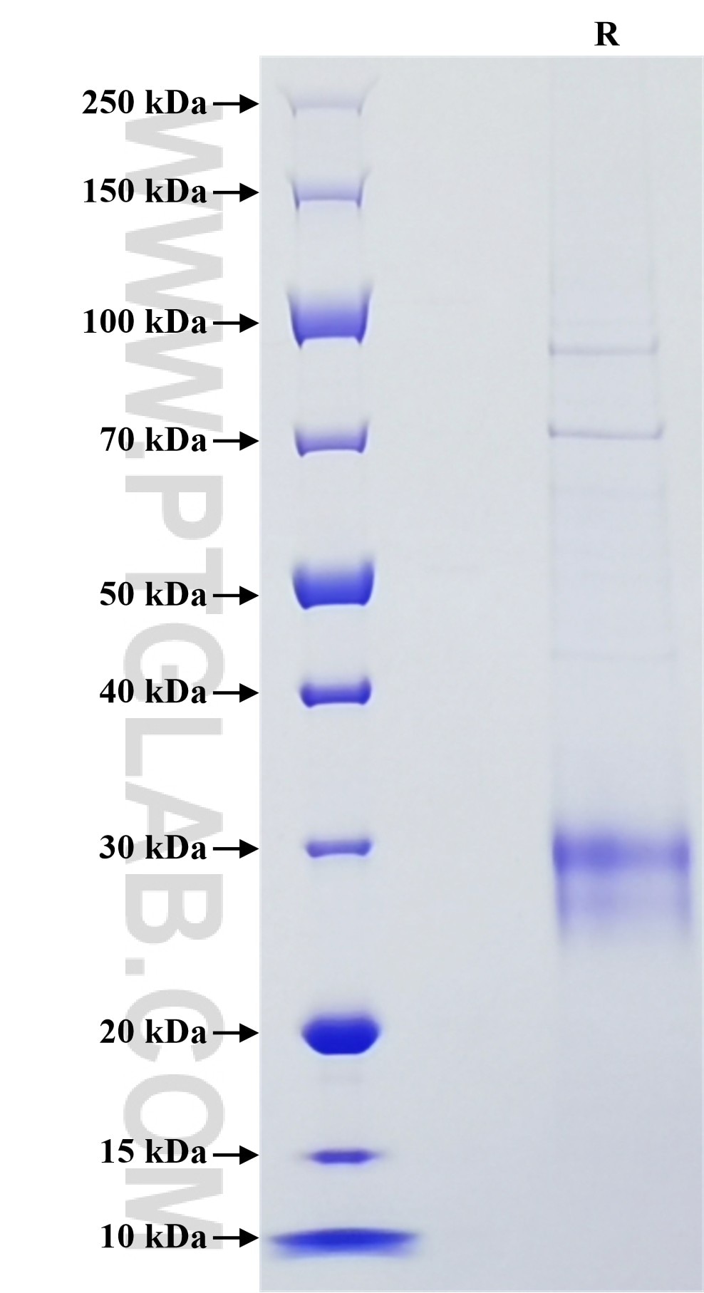 Purity of Recombinant Rat IL-10 was determined by SDS-PAGE. The protein was resolved in an SDS-PAGE in reducing (R) conditions and stained using Coomassie blue. Purity of Recombinant Rat IL-10 was determined by SDS-PAGE. The protein was resolved in an SDS-PAGE in reducing (R) conditions and stained using Coomassie blue.