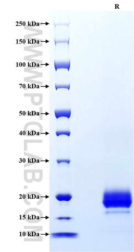 Purity of Recombinant Mouse VEGF120 was determined by SDS-PAGE. The protein was resolved in an SDS-PAGE in reducing (R) conditions and stained using Coomassie blue. Purity of Recombinant Mouse VEGF120 was determined by SDS-PAGE. The protein was resolved in an SDS-PAGE in reducing (R) conditions and stained using Coomassie blue.